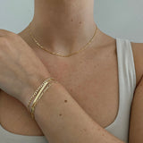 The Forever Albert Chain